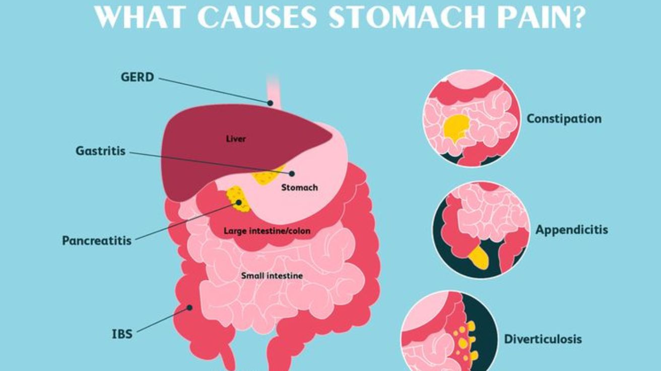 stomach pain causes like consitipation, GRED, Gastritis and IBS.